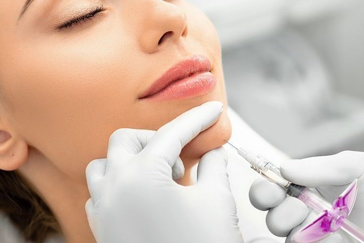 Dermal Fillers London Aesthetics By Shanty