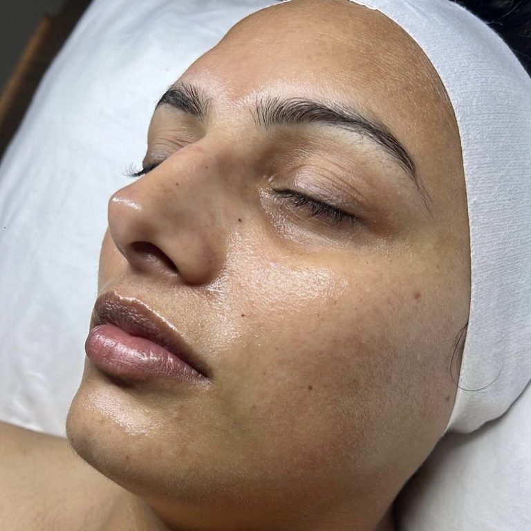 Hydrafacial London Aesthetics by Shanty